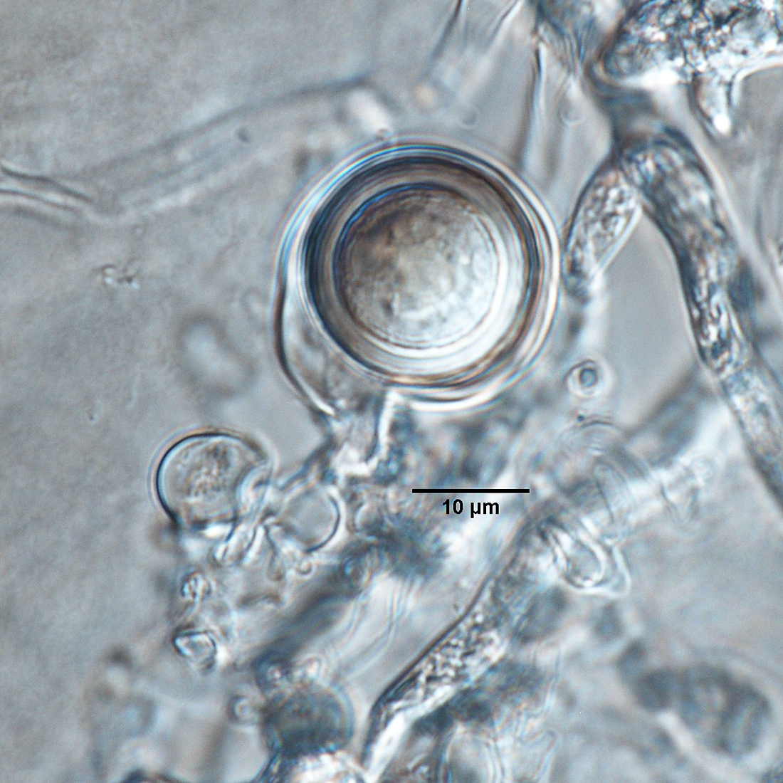   Phytophthora quercetorum  (ex-type CPHST BL 52G) sexual phase: smooth-walled oogonium with comma-shaped tapered base, paragynous antheridium, and aplerotic oospore; photo by Gloria Abad, USDA-APHIS-PPQ. 

